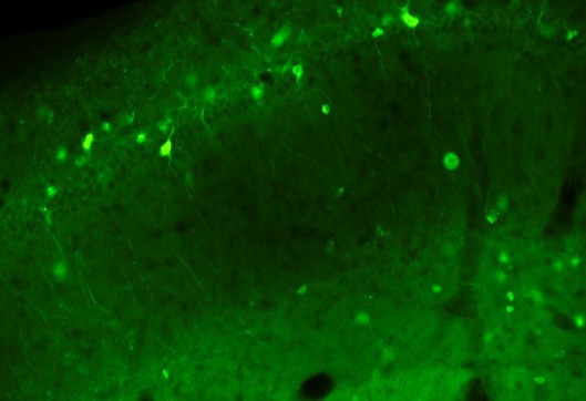 Gli interneuroni GABAergici che esprimono la proteina verde GFP nell’ippocampo dei topolini Dravet.